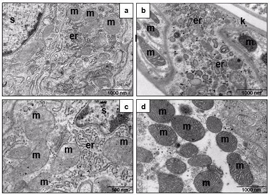 b: A Cylisticus convexus esetében a cotyledon középső szakaszában vezikuláris durva felszínű endoplazmatikus retikulum és mitokondriumok találhatóak. c: A cotyledon nagyobb felbontású részlete (T.