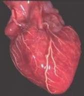 DEFINÍCIÓ A szívizom ischaemia olyan állapot, amelyben a szívizom artériás vérellátása nem biztosít elegendő oxigént ahhoz, hogy az intracelluláris energia-háztartás ne tolódjon el az