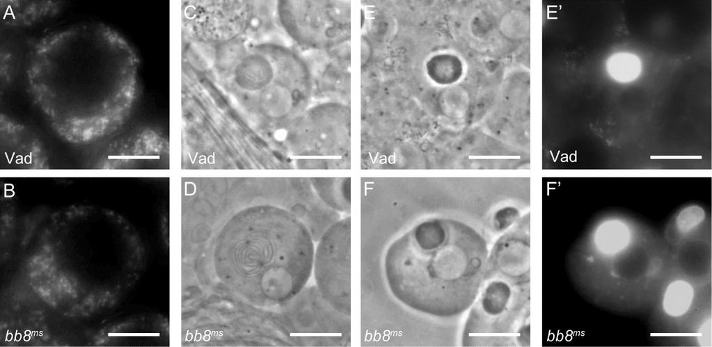4.5 A bb8 ms mutánsok mitokondrium morfológiai hibákat mutatnak, és megamitokondriumokat képeznek Mivel a Bb8-GFP és a Bb8 N100as -GFP is egyértelműen mitokondriális lokalizációt mutat, megvizsgáltuk