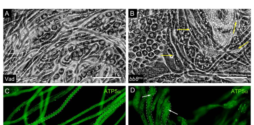 mutánsok tesztiszében a nagyméretű vezikulák membránja festődést mutatott az ATP5- szintáz alfa ellenanyaggal (18. Ábra C-F).