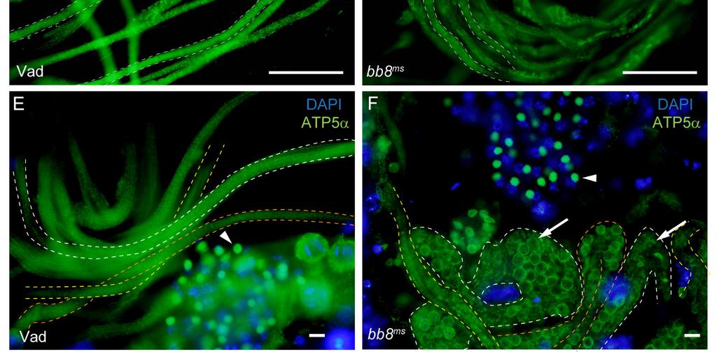 Ábra Mitokondriális rendellenesség a bb8 ms mutánsokban Vad típusú (A) bb8 ms mutáns (B) ciszták fáziskontraszt mikroszkópos képe. Sárga nyilak jelölik a cisztákban található vezikulákat.