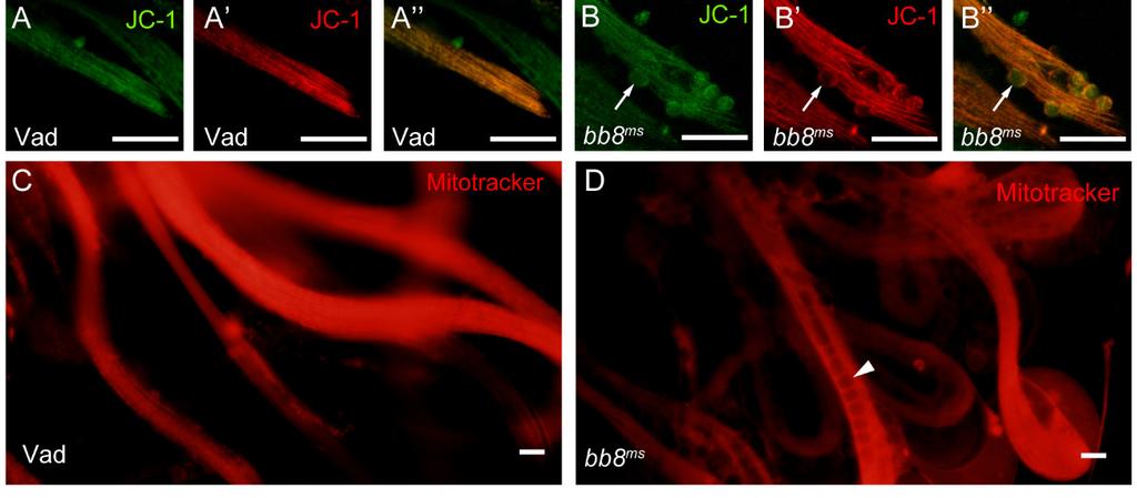 A morfológiai változások mellett, megvizsgáltuk a megnyúlt ciszták mitokondriumainak membránpotenciálját.