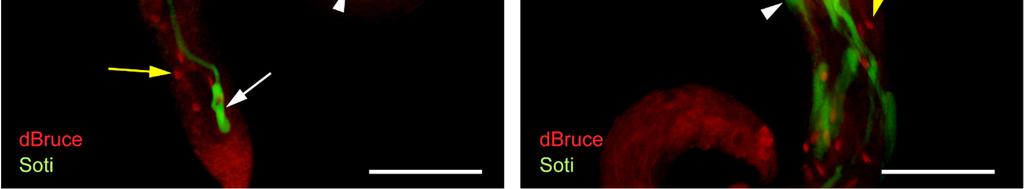 mtsai. 2003). A hasonlóság okán anti-dbruce ellenanyaggal vizsgáltuk a fehérje lokalizációját vad típusú és ago ms mutáns tesztiszben (28. Ábra).