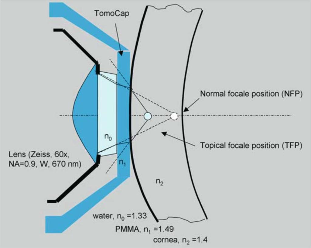 könnyfilm, 4 objektív lencse (SSCM) 9. ábra. A cornea és a TomoCap kapcsolata (91).