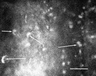 8-9µm széles reflektív képződményeket is észleltünk, melyek valószínűleg trophozoitáknak felelnek meg (36. ábra)
