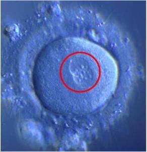 Zygota A két haploid mag=> diploid zygota A spermium