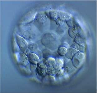 Blastocysta Trophoblast sejtek, extraembryonális szövetek Blastocysta üreg (apoptózis) =extra embryonális coeloma üreg Emryoblast sejtek