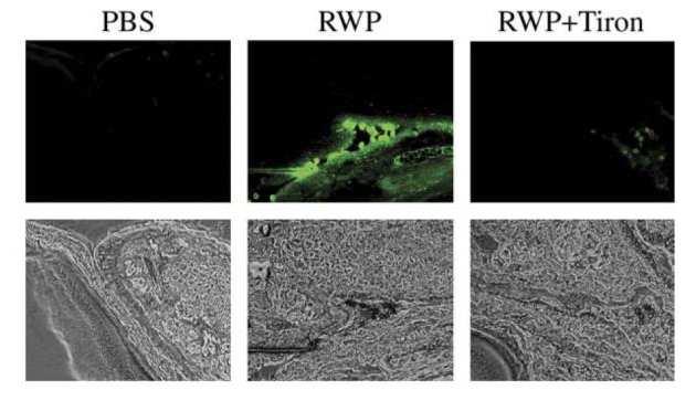 15. ábra. A ROS szintjének változása az egerek kötőhártyájában helyi parlagfű pollen (RWP) kezelés után Felső képek: DCF fluoreszcencia az egerek kötőhártyájában PBS, RWP és RWP + Tiron kezelés után.