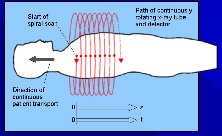6G Spiral CT - 1990 source & detector from 3G & 4G