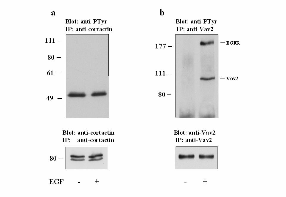 14. ábra: A rövid ideig tartó EGF kezelés nem eredményezi a cortactin tirozin foszforilációját. Szérummentes körülmények közt tartott COS7 sejteket EGF-fel kezeltünk, vagy kezeletlenül hagytunk.