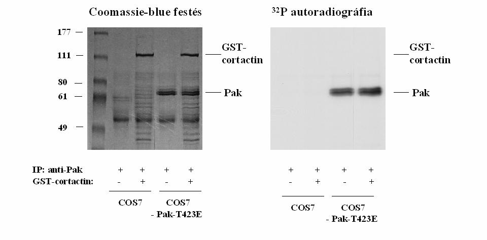 19.ábra: A PAK nem foszforilálja a cortactint in vitro.