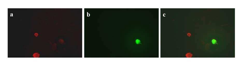 jóval kevésbé intenzíven világítanak zöld-fluoreszcenciával vizsgálva, mint a kontroll vektort expresszáló szétterült sejtek, tehát feltehetőleg azon sejtek terülnek szét, melyekben a cortactin