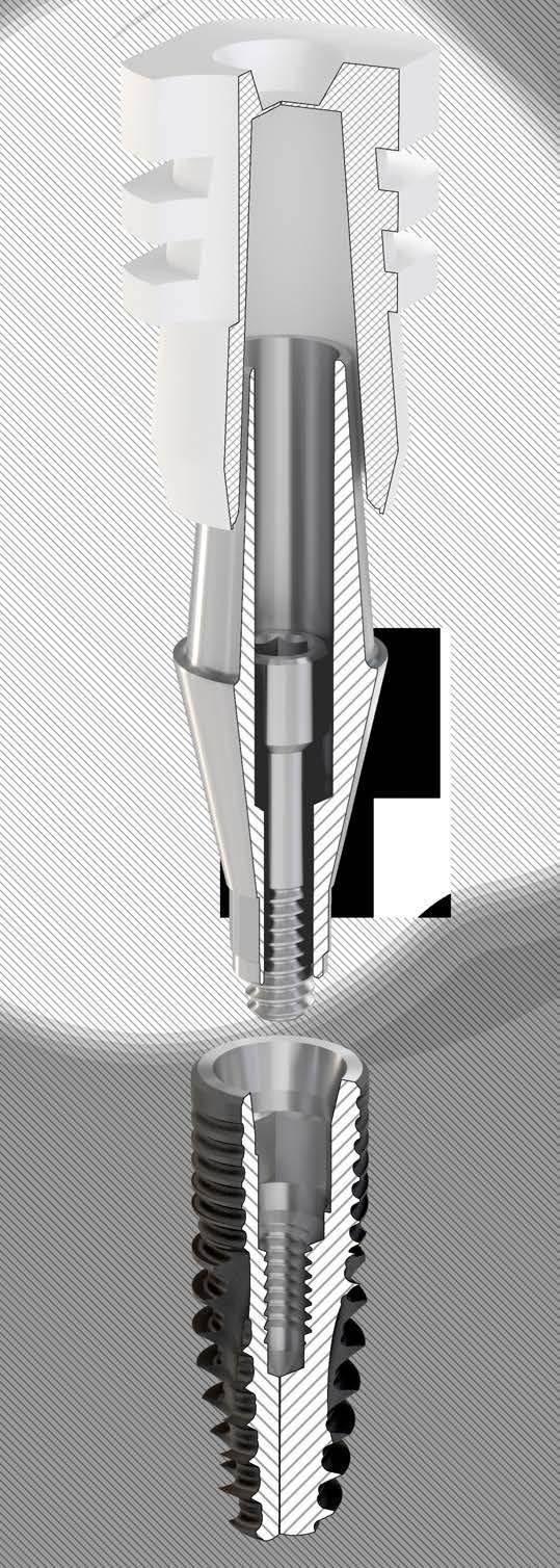 A Koreából származó ICX templant német implantátum rendszerre azért esett a választásunk, mert igen