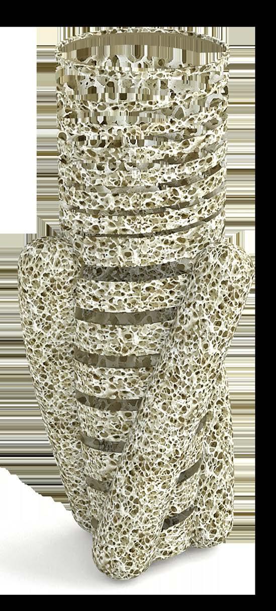 30 BIOKOSÁR Hajdú József Mitől függ az implantátum stabilitása?
