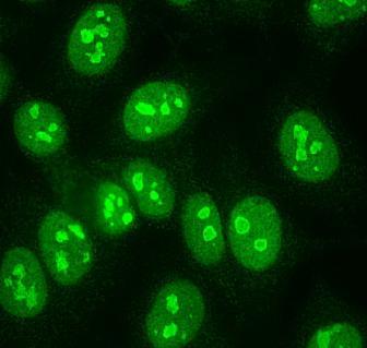 Antinukleáris antitestek (ANA) kimutatása immunfluoreszcens módszerrel -