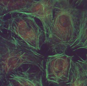 Antinukleáris antitestek (ANA) kimutatása immunfluoreszcens módszerrel - gold standard F-Aktin Vimentin A sejt