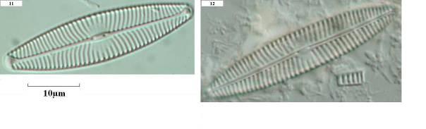 Cocconeis placentula var. euglypta, 5.Amphora pediculus, 6.Gomphonema olivaceum var. olivaceum, 7.