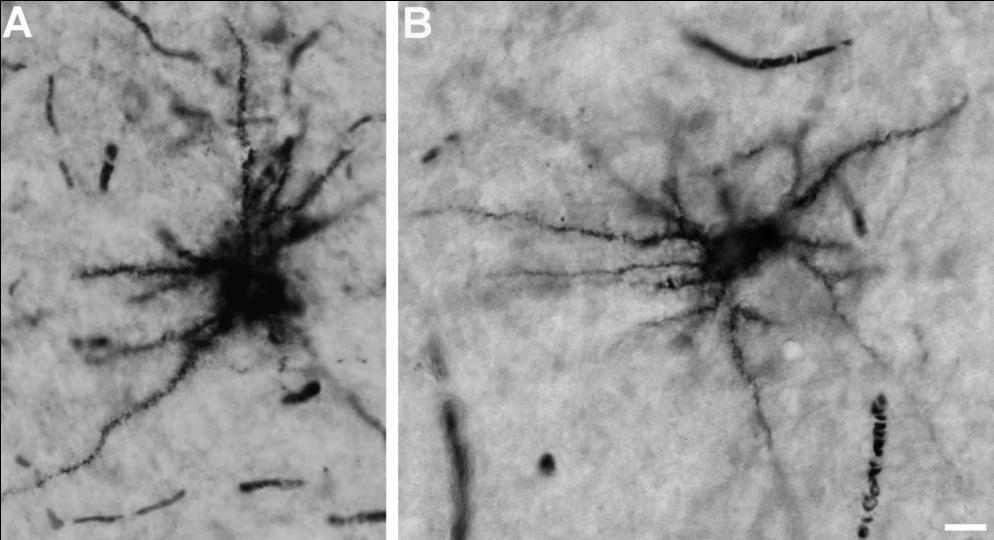 parvocelluláris rétegek. Lépték = 1 mm. WFA lektinhisztokémiai jelöléssel sem perineuronális hálók, sem periaxonális hüvelyek nem festődtek a corpus geniculatum lateraleban.