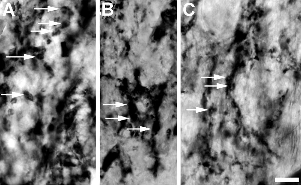 5.2.2. CRTL-1 immunreaktivitás jellemzői a külső térdestestben A CRTL-1-immunreaktivitás során kapott eredményeink hasonlítottak, de nem teljesen azonosak a HAG7D4 immunfestés eredményeivel.