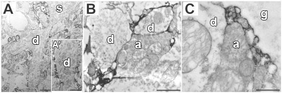 5.2.7. Elektronmikroszkópia Ultrastruktúrális szinten HAG7D4 immunreaktivitást a szóma körül kevésbé, inkább a dendritek proximális szakaszai körül azonosítottunk (19. ábra A).
