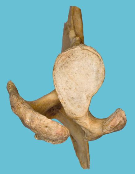 supraglenoidale L Angulus lateralis A Cavitas glenoidalis A