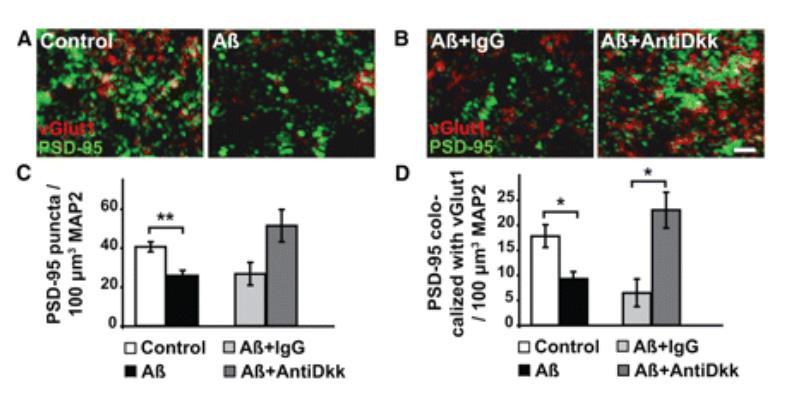 Decrease in the number of the postsynaptic marker PSD95 The Secreted Wnt Antagonist Dickkopf-1 Is Required for Amyloid β- Mediated Synaptic Loss http://www.jneurosci.org/content/32/10/3492.