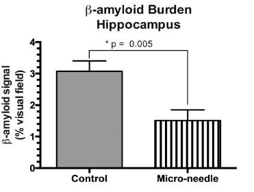 Transient Micro-needle Insertion into Hippocampus Triggers Neurogenesis and