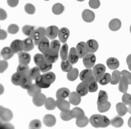 Babesia gibsoni, Mycoplasma haemofelis,, Mikrofilaria)