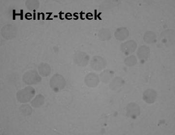 PCR! A fénymikroszkópos