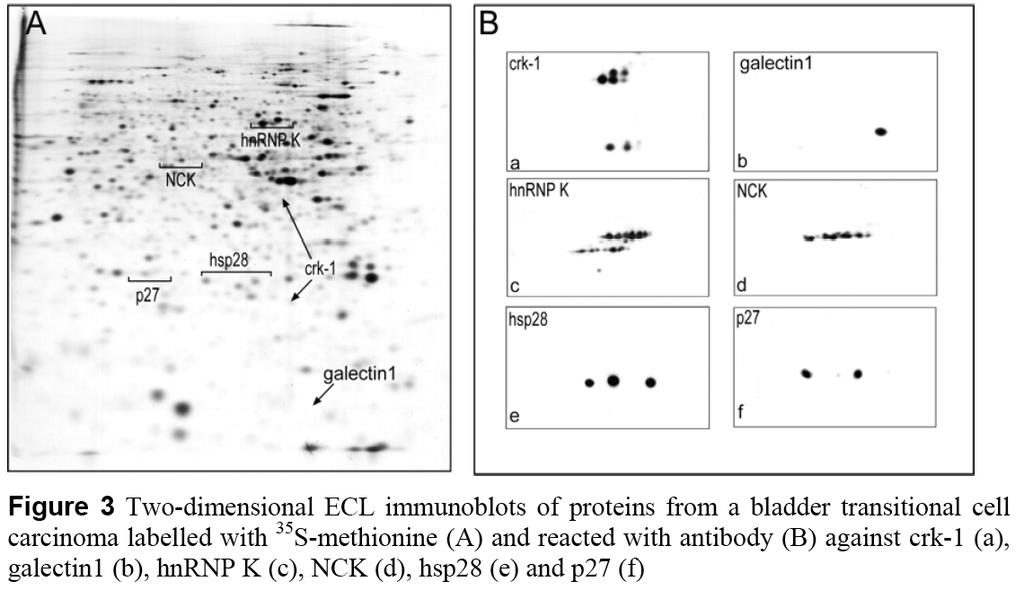 Példa 2 Példa 3 Immunizálás humán myeloma IgG Fc fragmenssel, a monoklonális