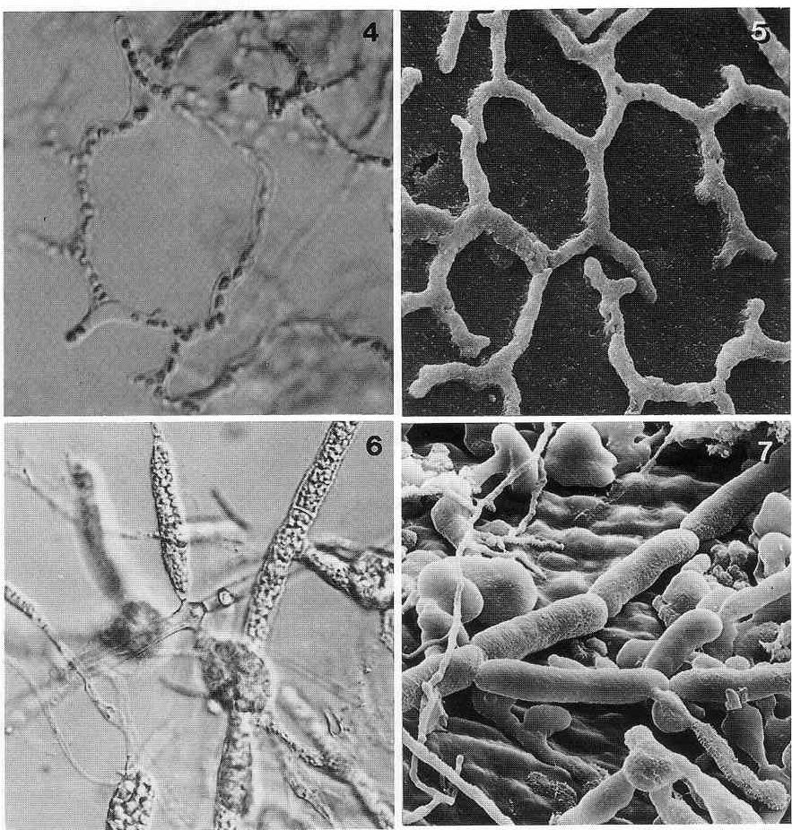 Microbial endoliths and erosion features Boring bacteria