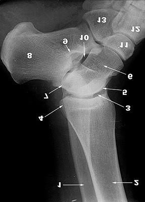 A BOKAÍZÜLET LATERALIS RTG- FELVÉTELEN 1. Fibula 2. Tibia 3. Articulatio talocruralis 4. Malleolus medialis 5. Trochlea tali 6.