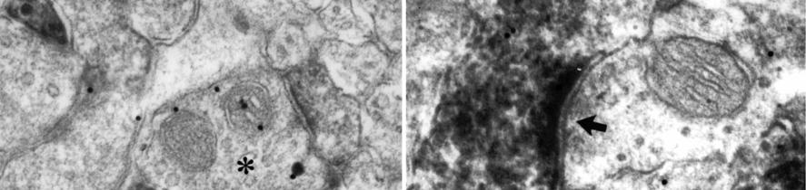 Lépték: 0,2 µm.