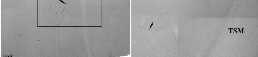 A: a fotómontázs a rostralis szinten az AcS (nucleus accumbens, shell) és a bed nucleus of stria terminalis, pars lateralis