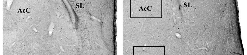 A, B: alacsony feloldású képek rostralis (A) és caudalis (B) szinteken.