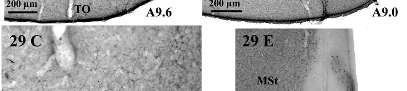 Az accumbens shell (AcS) területe jóval gazdagabb NPY+ rostokban (C),