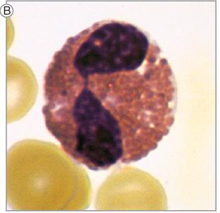 Eozinofil granulocita Arányuk a perifériás vérben: 3-5% Az eozinofilek legnagyobb számban a nyálkahártyákban vannak Vezikulumokban proteinek: antimikrobiális hatás Prostaglandinok és