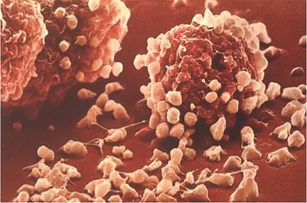 Hízósejtek (angol: mast cells) IgE-t kötő hízósejt Mieloid(?