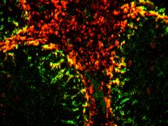 anionos polimerek (oxidált/acetilált LDL) Atherosclerosis pathogenezisében nagyon