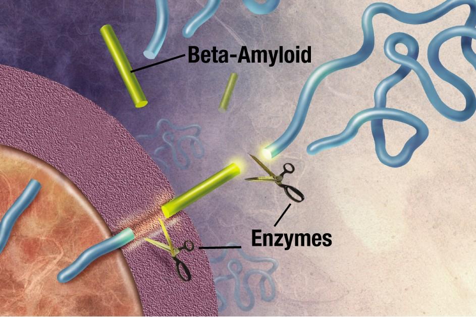Alzheimer kór, β amiloid plakkok kialakulása in vivo