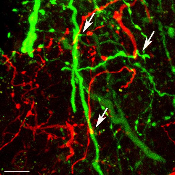 Kalibrációs vonal: 20 µm. 40.