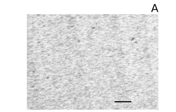 7. ábra (A) HS-MT32 aptamer SPR chip háttér korrigált válaszgörbéje különböző ASPV fertőzött növényi kivonat hígítások esetén.