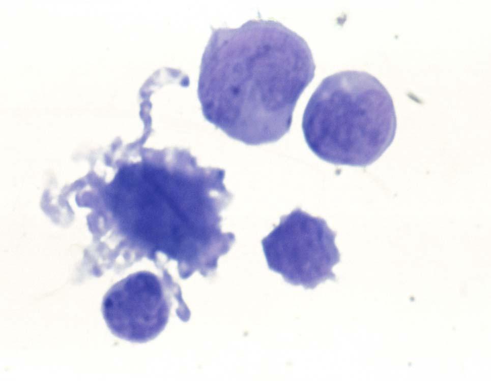 Antigen Presenting Cell is