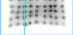 ACCEL-2000) Az Anger logika X = A / (A+B) Y Y = C / (C+D) E