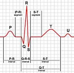 Unit Action Potential (MUAP) Elektrokardiogram Magas frekvenciás EKG His-köteg elektrogram Jobb-pitvari elektrogram Jobb-kamrai elektrogram Vektrokardiogram