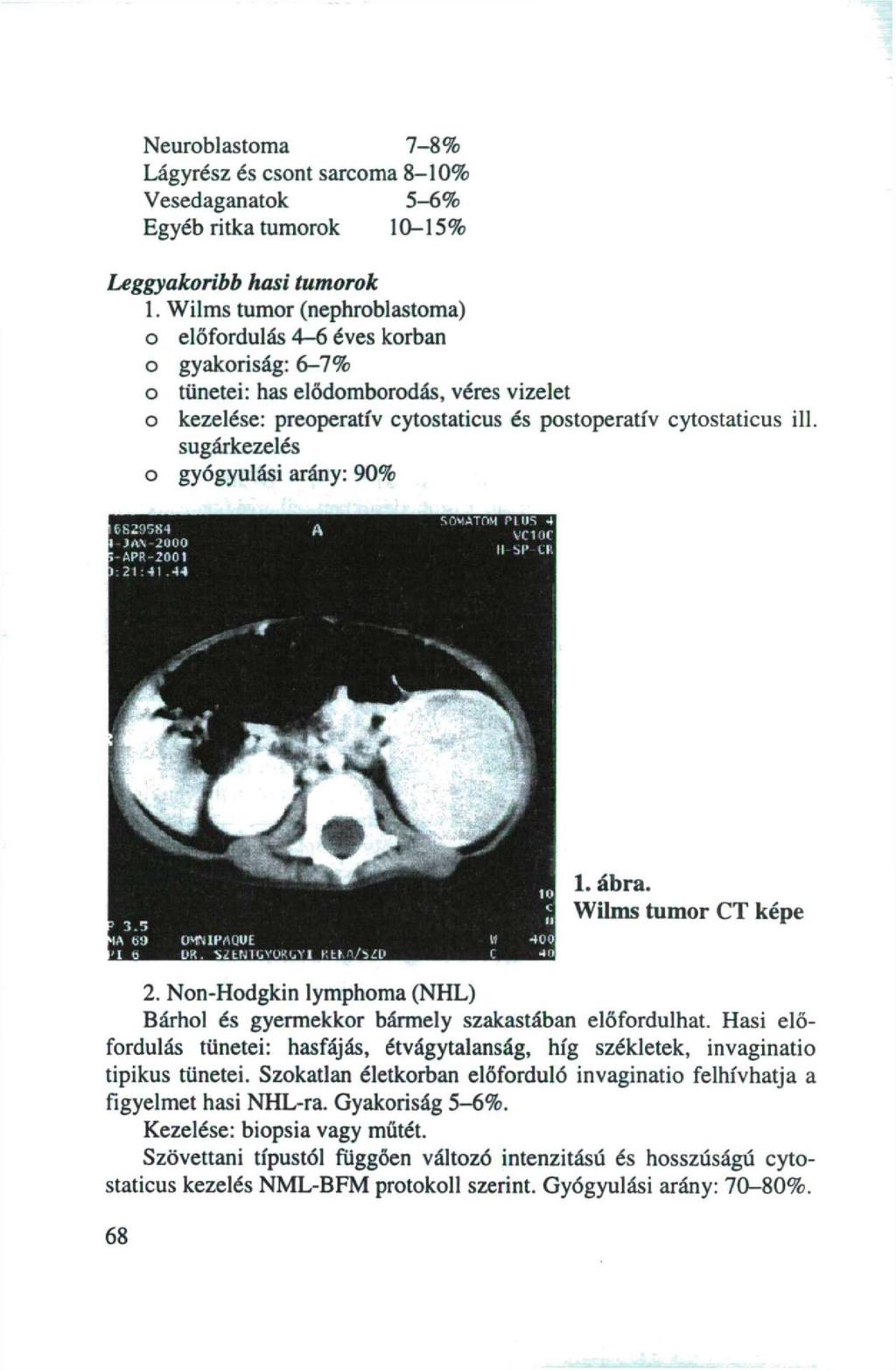 Neuroblastoma 7-8% Lágyrész és csont sarcoma 8-10% Vesedaganatok 5-6% Egyéb ritka tumorok 10-15% Leggyakoribb hasi tumorok 1.