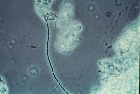 KÖRNYEZETBIOLÓGIA TERMÉSZETVÉDELEM Figure 1. Thiotrix nivea (magnified 400 times) Figure 2.