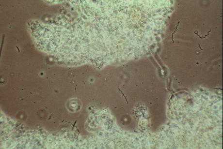 2) signals the first stage of oxygen deficiency and an increase in the load.
