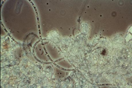 the creation of stagnant "dead zones". Figure 3. Beggiatoa thread (magnified 400 times) Figure 4.