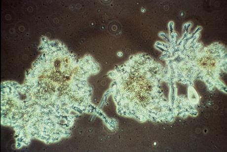 3) point to insufficient clarification level, the formation of hydrogen sulphide, and the stage of